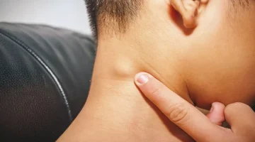 علاج التهاب الغدد الليمفاوية تحت الابط بالاعشاب