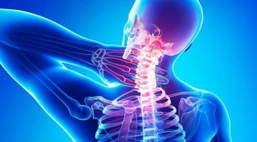 أعراض ضغط فقرات الرقبة على الأعصاب