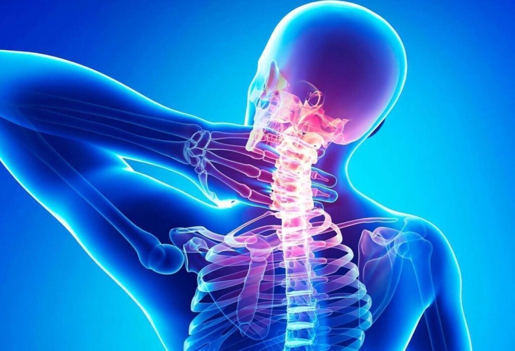 أعراض ضغط فقرات الرقبة على الأعصاب