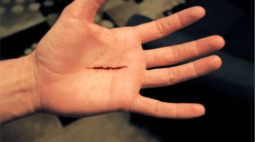 تفسير حلم ظهور شعر في كف اليد في المنام