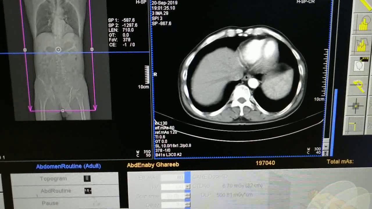 هل يجب الصيام قبل أشعة الصبغة للرحم