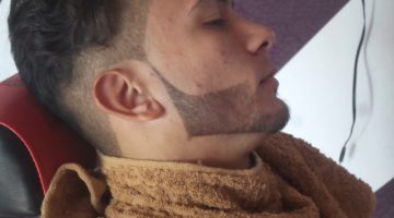 صبغ اللحية بدون حساسية