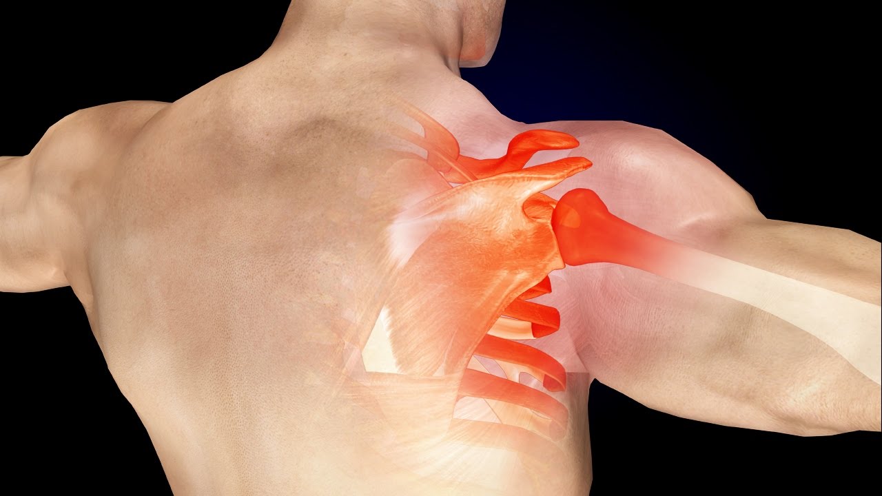الم في الكتف الايمن من الخلف والامام