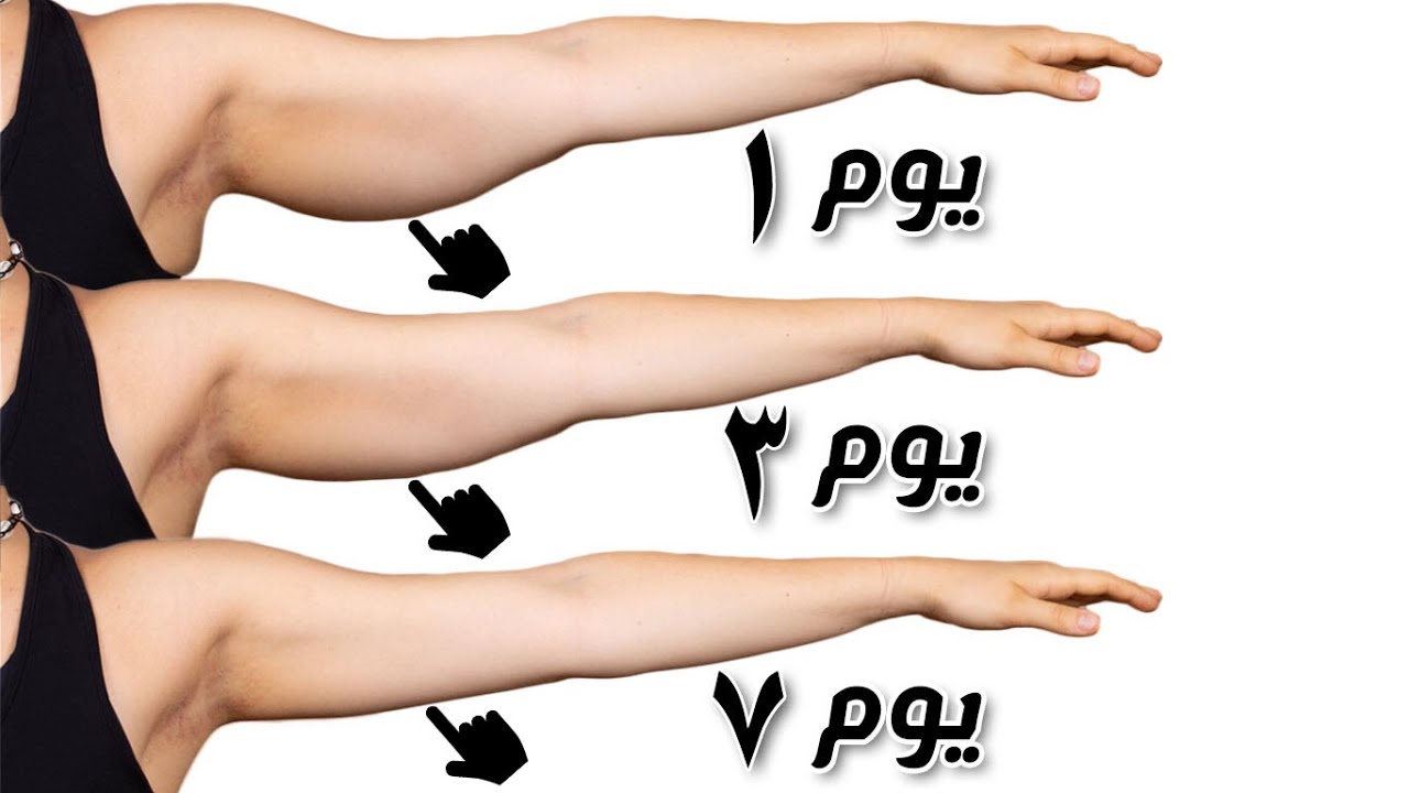 تجربتي مع عملية شد الذراعين