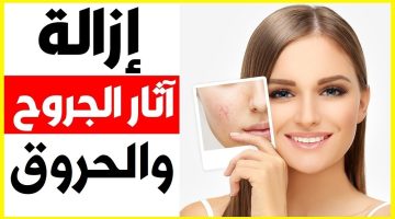وصفة سحرية لإزالة آثار الجروح القديمة المستعصية