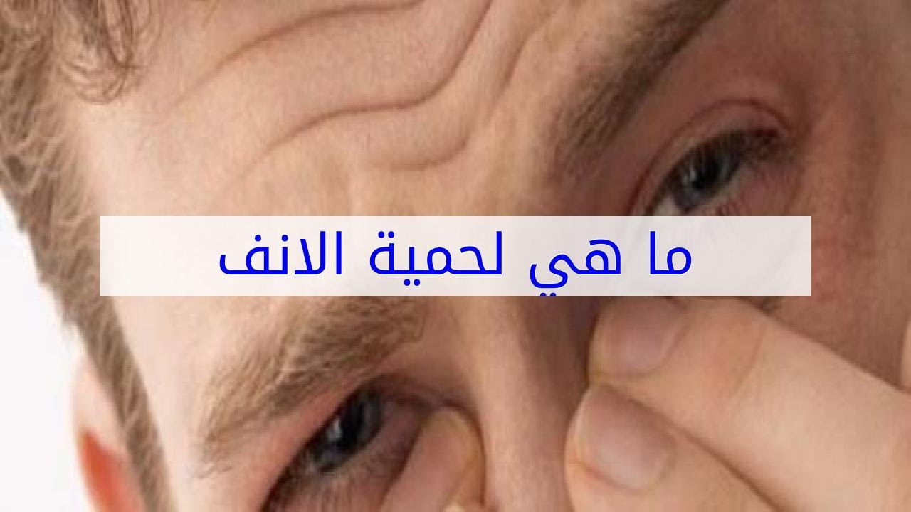 لحمية الأنف في جهة واحدة