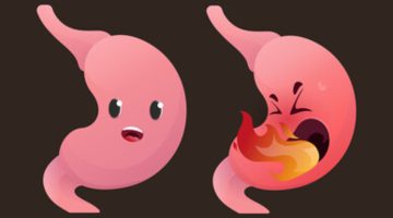 أعراض عسر الهضم الشديد