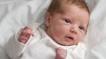 شكل أطفال متلازمة داون حديثي الولادة