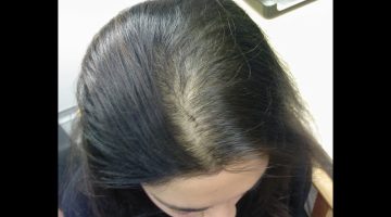 تفسير حلم فراغات في الشعر