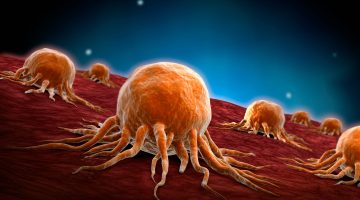 الفرق بين الغدد اللبنية والسرطان