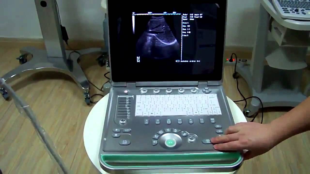 حمل الولد متى يبان بالتحليل