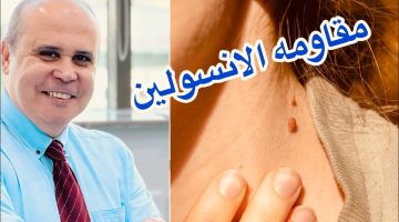 علاج مقاومة الأنسولين بالأكل