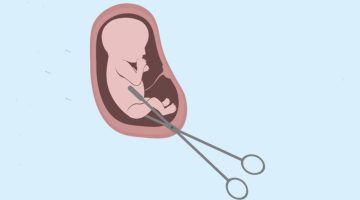 حلمت اني أجهضت وشفت الجنين ولد