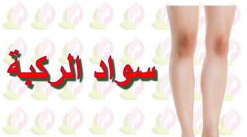 تجربتي مع سواد الركب