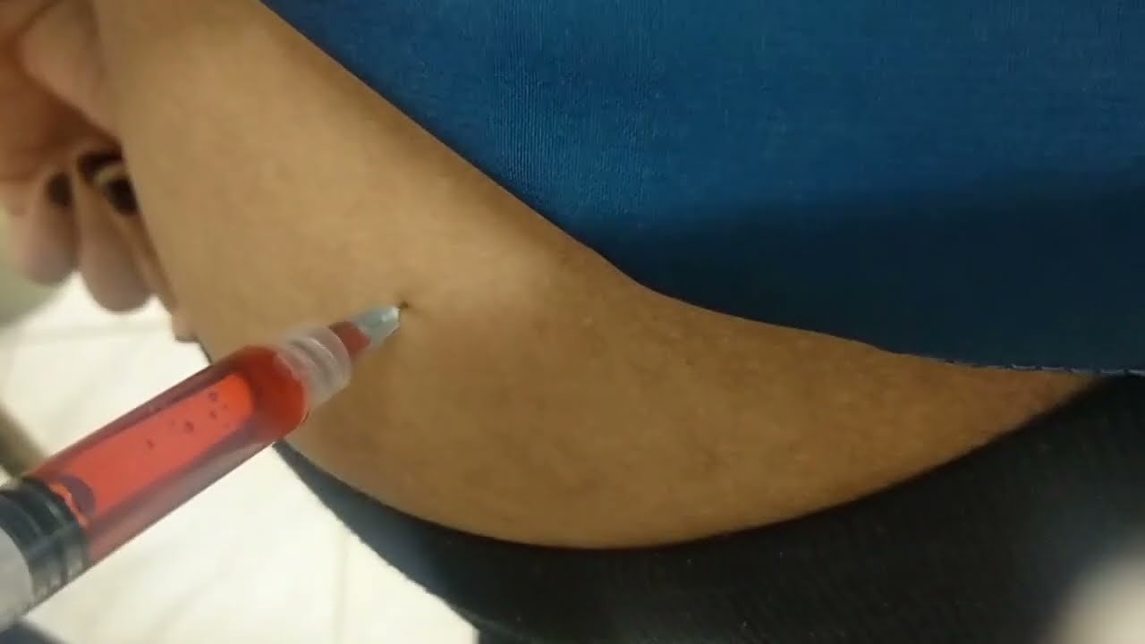 كيفية إعطاء الحقن للبنات