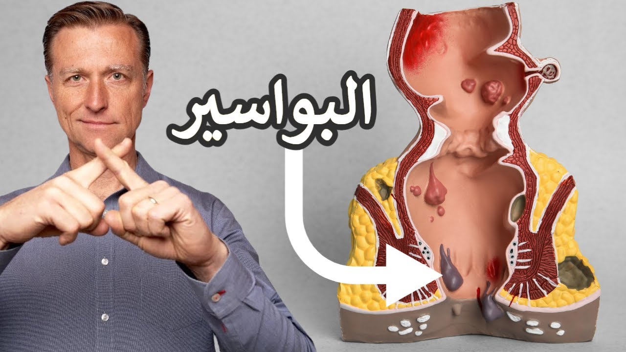 أعراض البواسير عند الرجال
