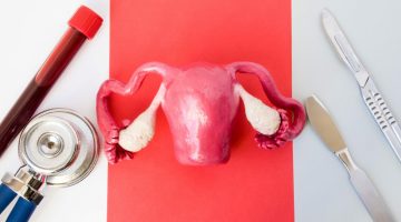 مين حملت بعد عملية تثقيب المبايض