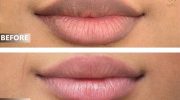 طرق تصحيح الشفاه بالكونسيلر