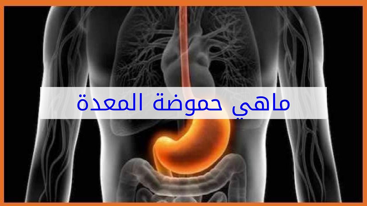 كيف تتخلص من حموضة المعدة