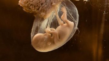 هل يمكن معرفة نوع الجنين من شكل كيس الحمل؟