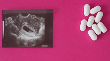 مدة الراحة بعد عملية تنظيف الرحم