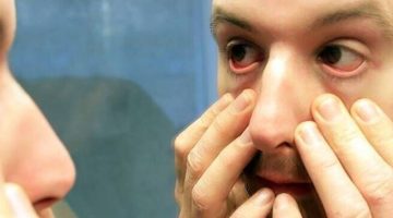 تفسير حلم العين المصابة لشخص آخر