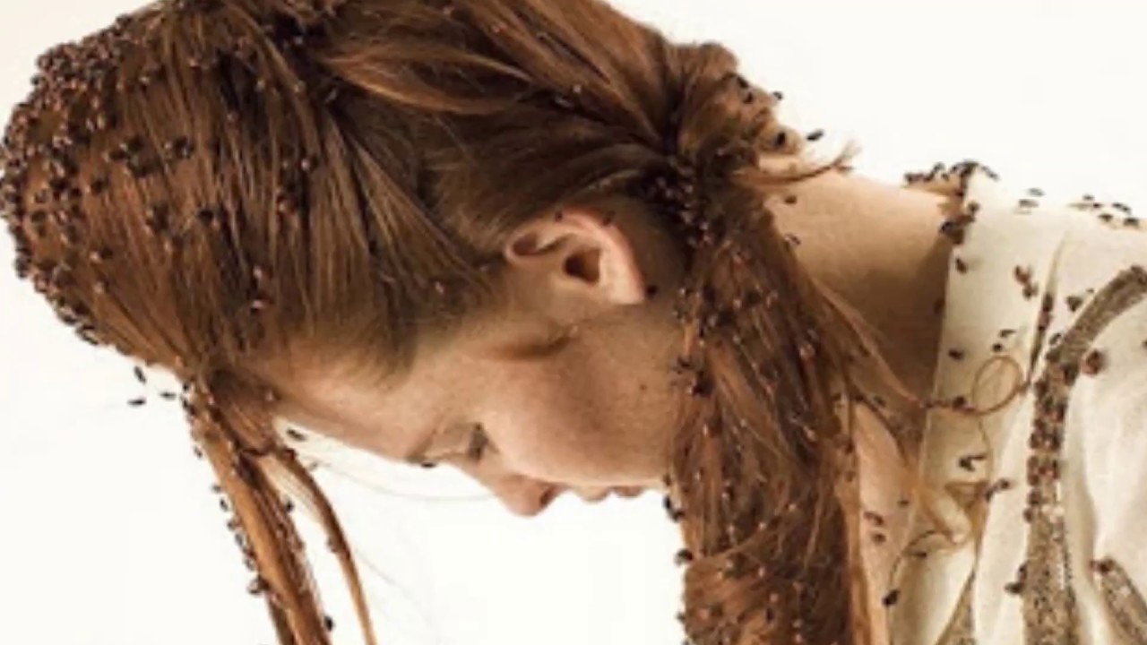 تجاربكم مع بف باف للقمل