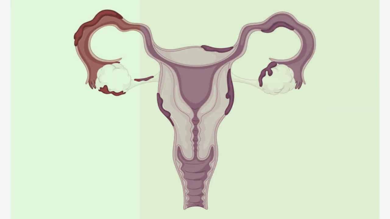 أعشاب تنزل الدورة في سن اليأس