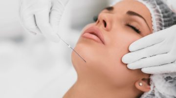 كم يدوم فيلر توسيال