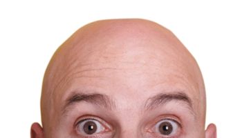 أسباب حرارة الرأس عند الرجال