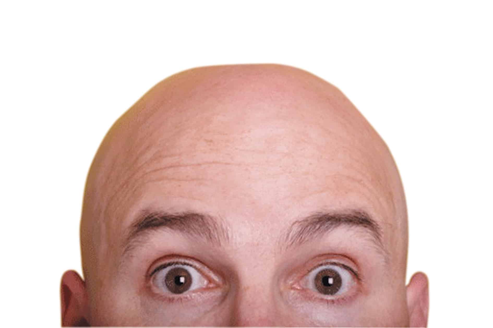 أسباب حرارة الرأس عند الرجال