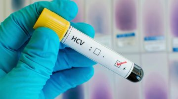 سعر تحليل الكبد الوبائي في السعودية 