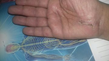 تفسير رؤية أصابع اليد اليسرى في المنام للمتزوجة