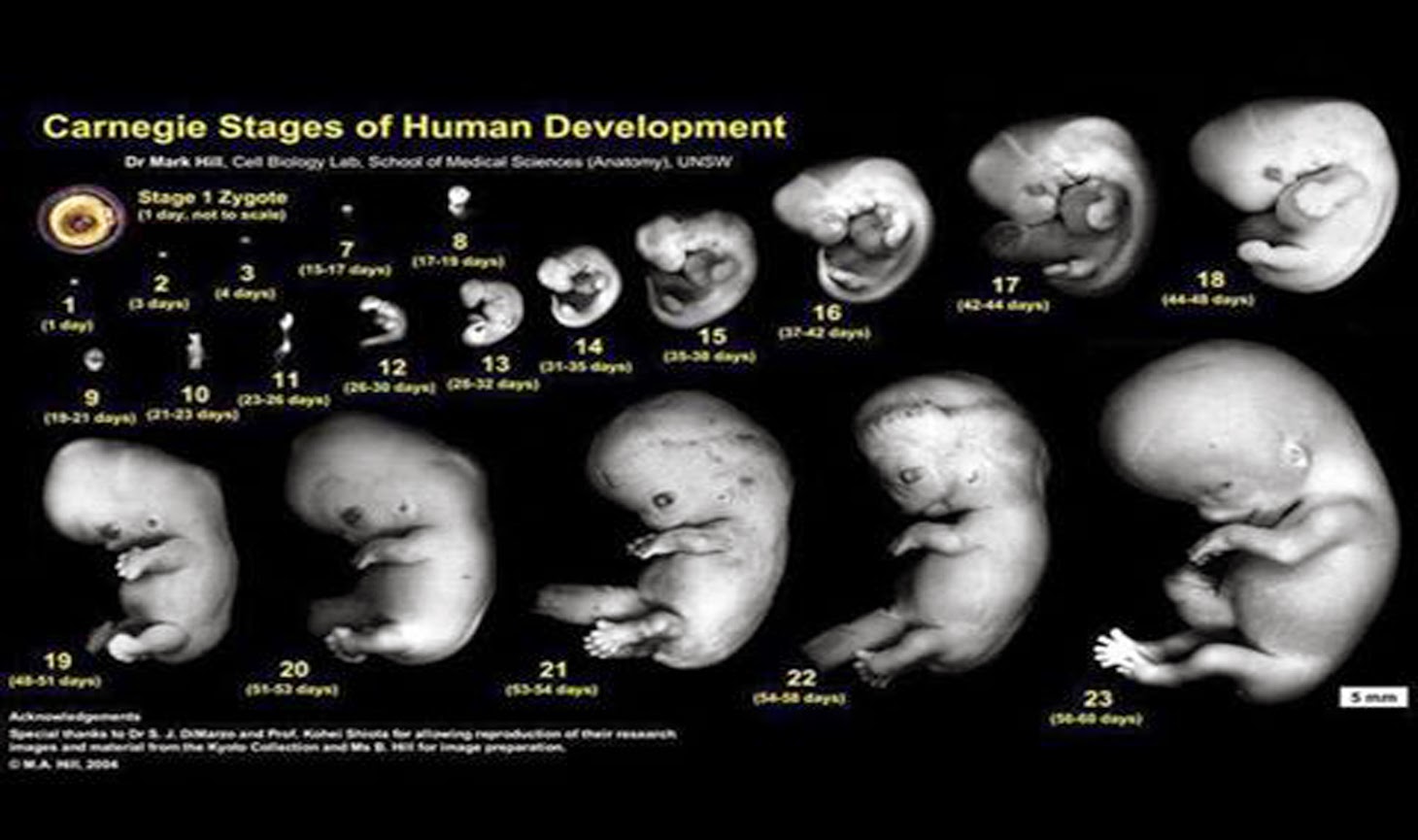 مين حست بحركة الجنين في الشهر الثالث
