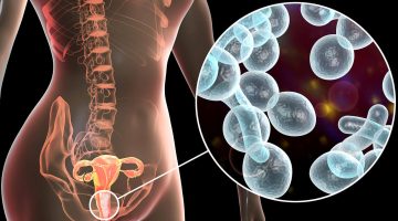 الفرق بين التهاب المهبل البكتيري والفطري