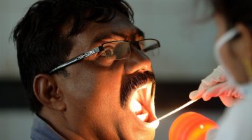 متى تظهر أعراض الإيدز في الفم وطرق العلاج