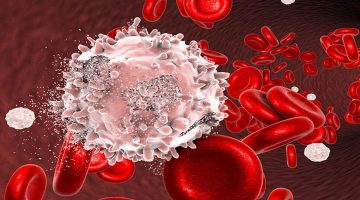 هل ميكروب الدم هو سرطان الدم