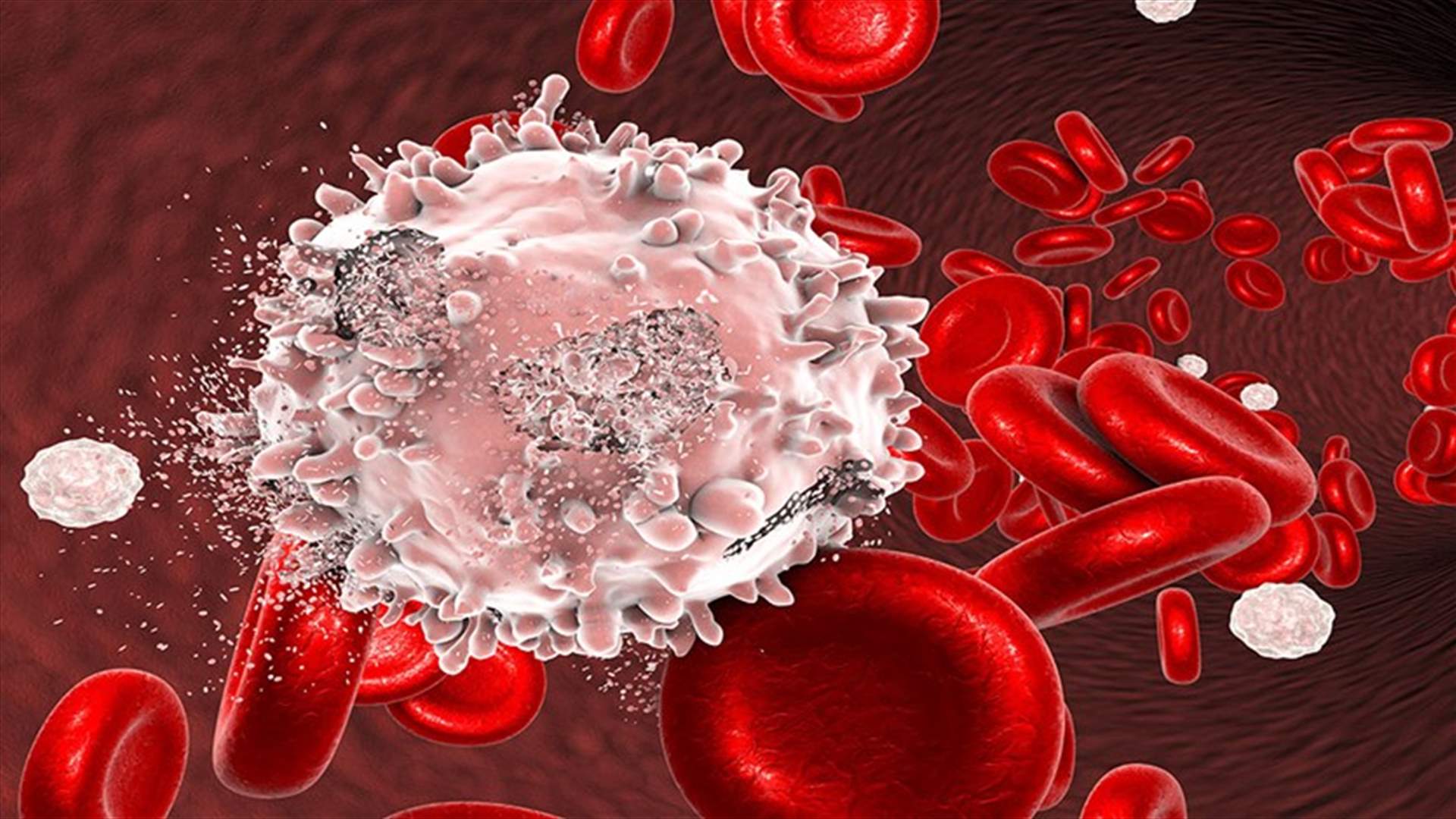 هل ميكروب الدم هو سرطان الدم