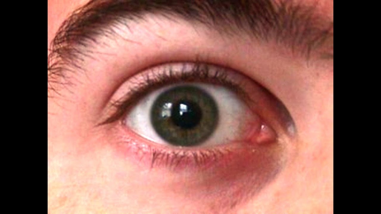 هل الغدة الدرقية سببها العين والحسد