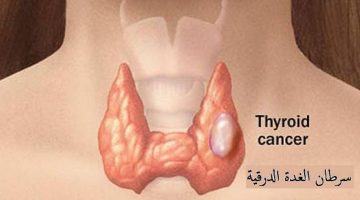علاج الغدة الدرقية بالماء الساخن