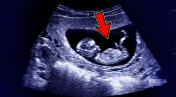 نبض الجنين الولد يظهر قبل البنت
